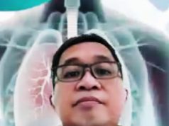 Gebrakan PDPI: Manfaatkan AI Radiologi dan Low-Dose CT Scan untuk Deteksi Kanker Paru